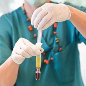 PRP-therapy preparation