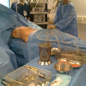 Breast reconstruction - Lipotransplantation